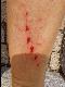 Perforation
