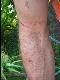 Blut
