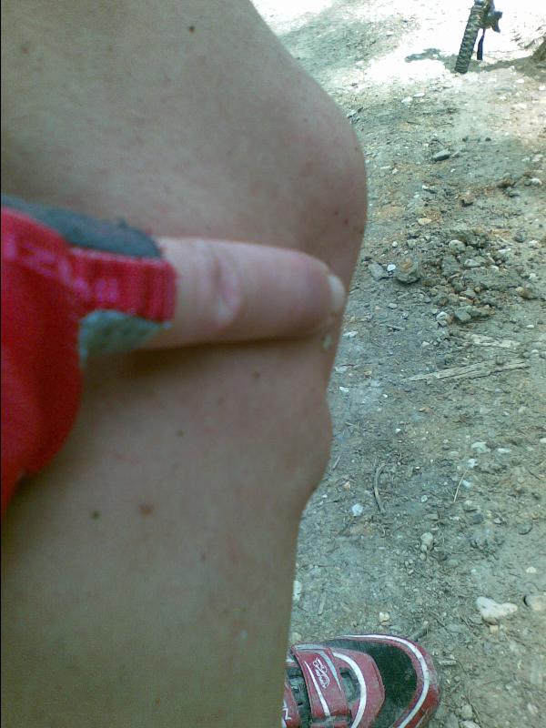 Arber, Arber!<br>Aua!