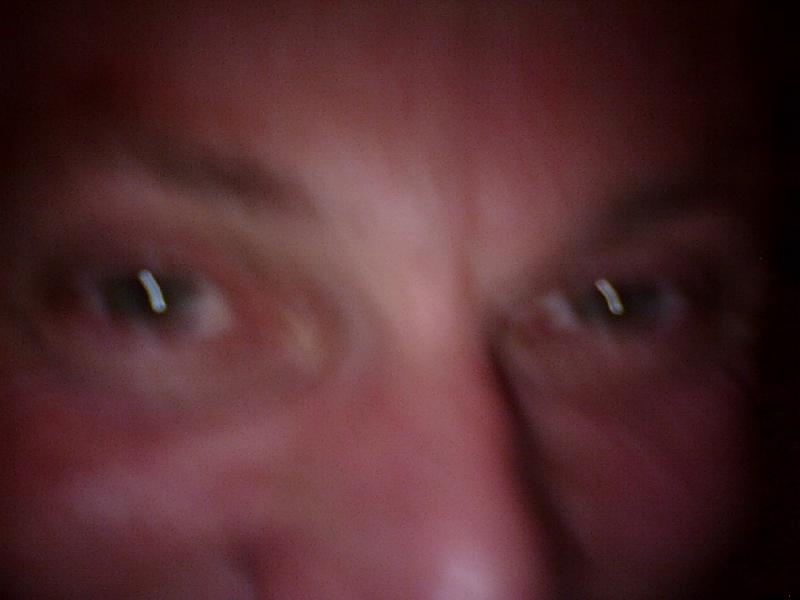 Augen IV