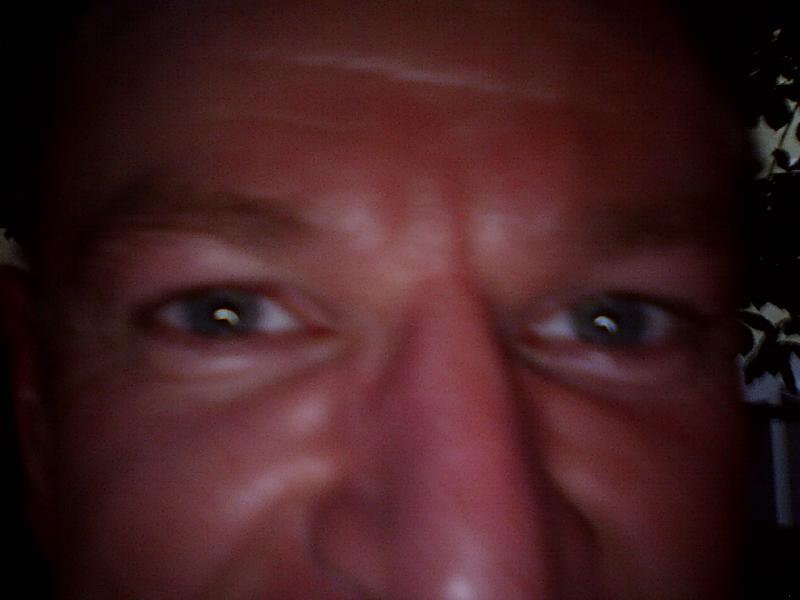 Augen X