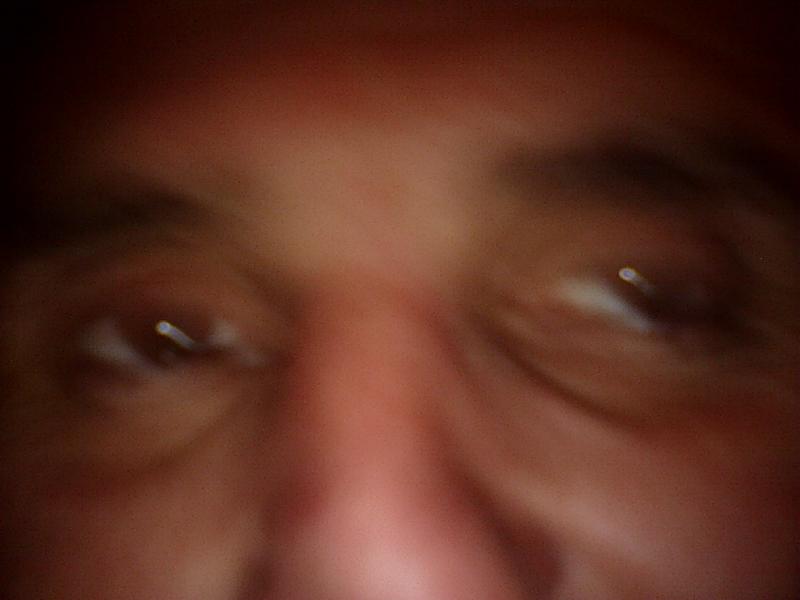 Augen XIII