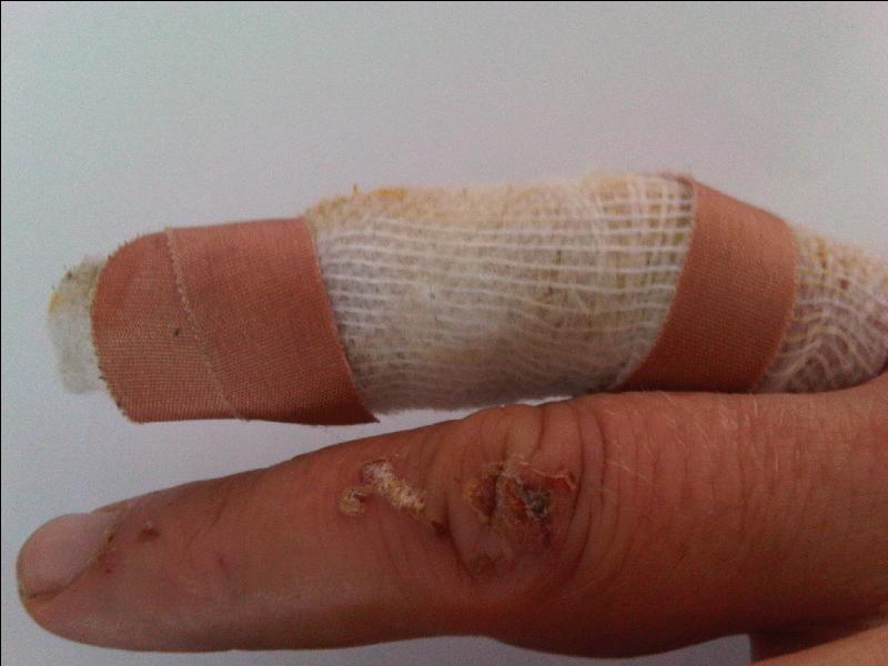 bser Finger