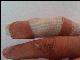 bser Finger